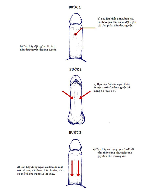 Bài tập Backward Puller