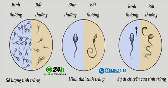 Nhận dạng tinh trùng